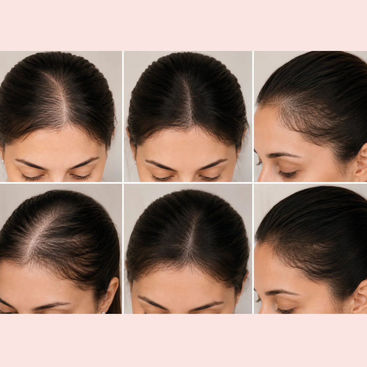 HAARSERUM