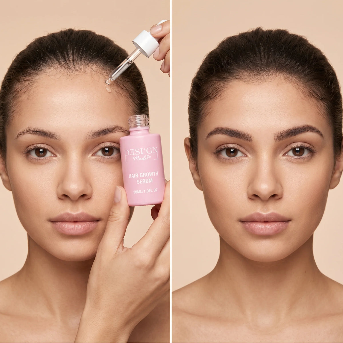 HAARSERUM